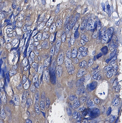 CaMKII Antibody