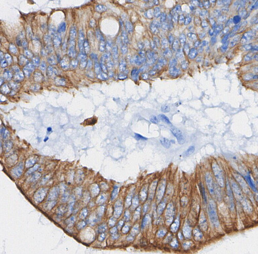 Cytokeratin 18 Antibody