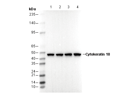 Cytokeratin 18 Antibody