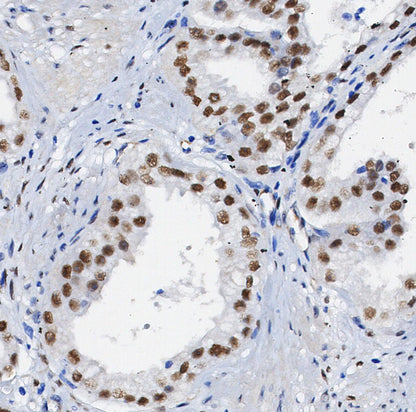 Dnmt3a Antibody