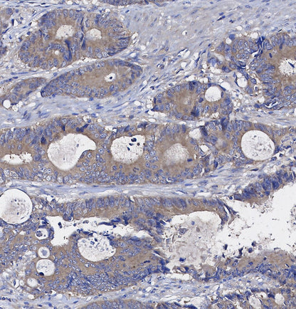 Galectin 1 Antibody