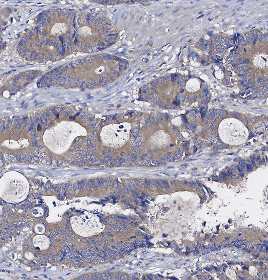 Galectin 1 Antibody