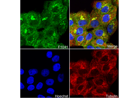 MMP14 Antibody
