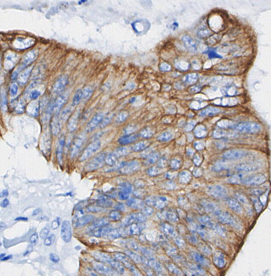 MMP3 Antibody