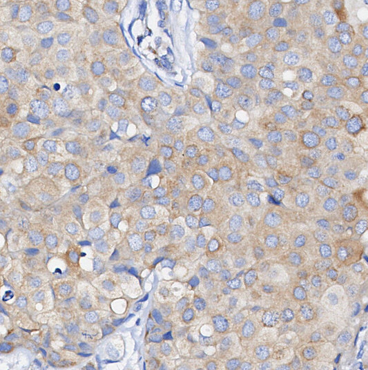 Phospho-Met/c-Met (Tyr1349) Antibody