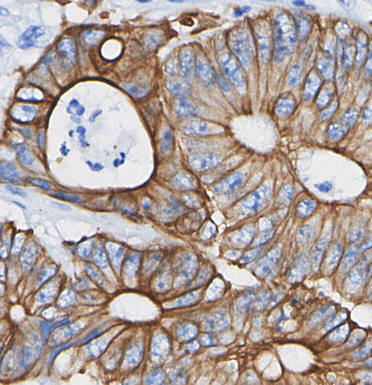 P Glycoprotein Antibody