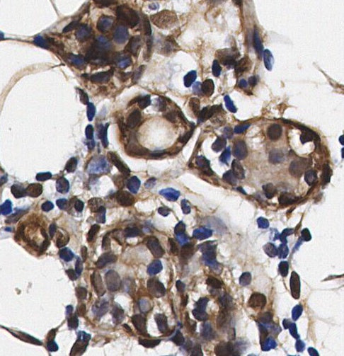 PAK2 Antibody