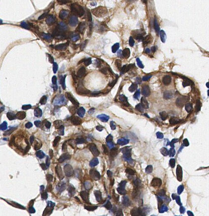 PAK2 Antibody