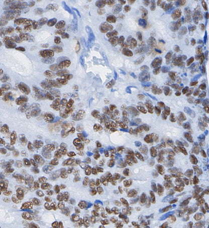 Smad5 Antibody