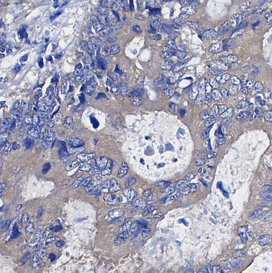 STUB1/CHIP Antibody