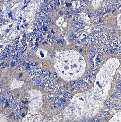STUB1/CHIP Antibody