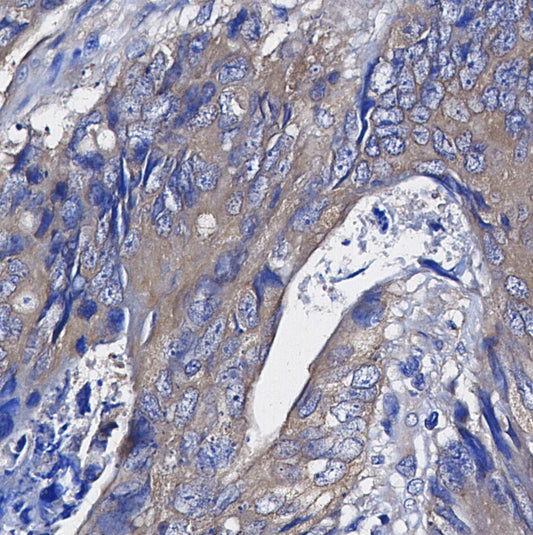 β2 Adrenergic Receptor Antibody