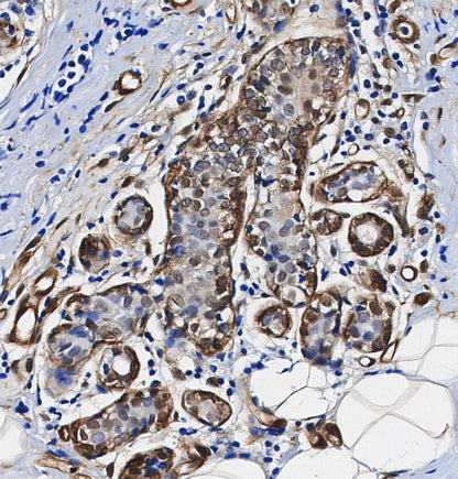 p73 Antibody