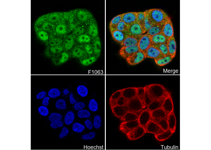 Estrogen Receptor α Antibody
