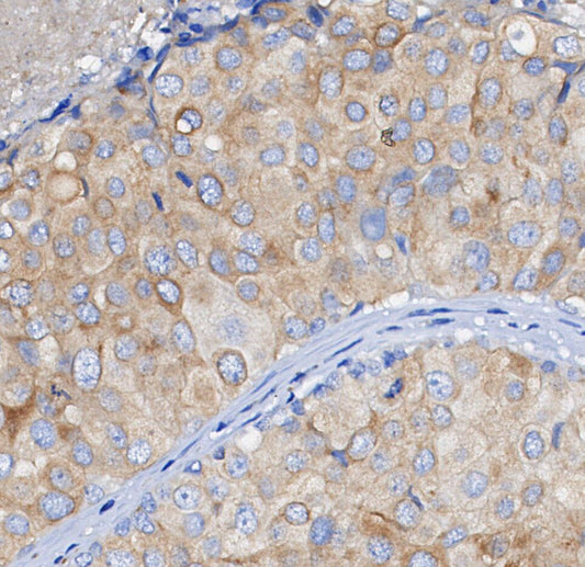 ATG4A Antibody