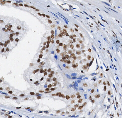 Brd4 Antibody