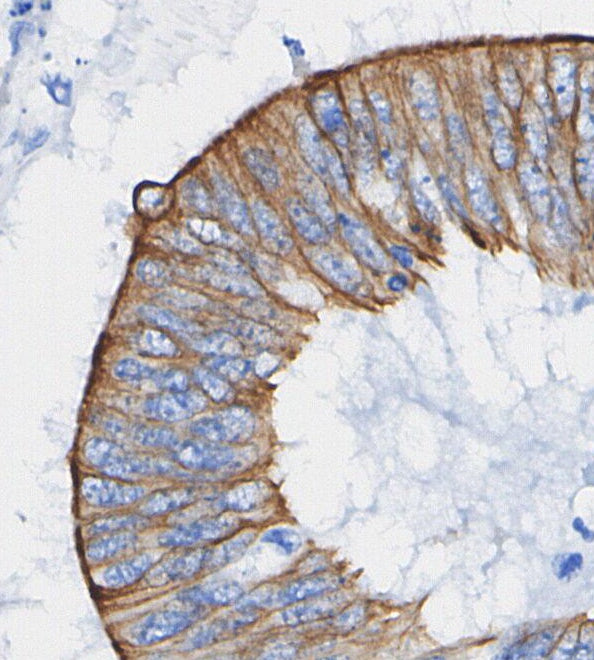 CDC42 Antibody