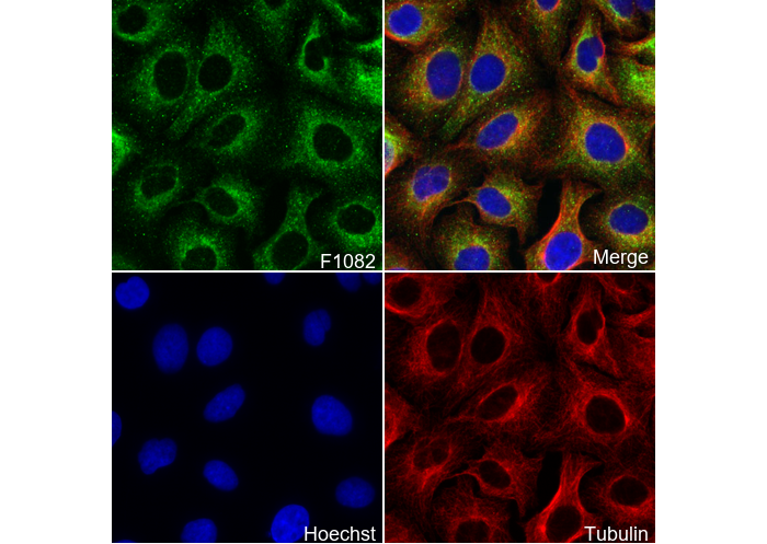 Cytokeratin 7 Antibody