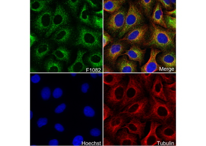 Cytokeratin 7 Antibody