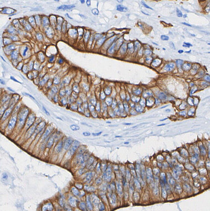 Cytokeratin 7 Antibody