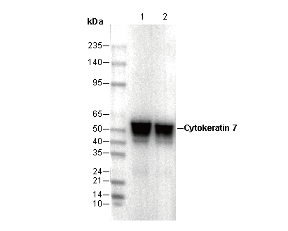 Cytokeratin 7 Antibody