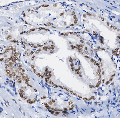 ERCC1 Antibody