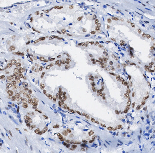 ERCC1 Antibody