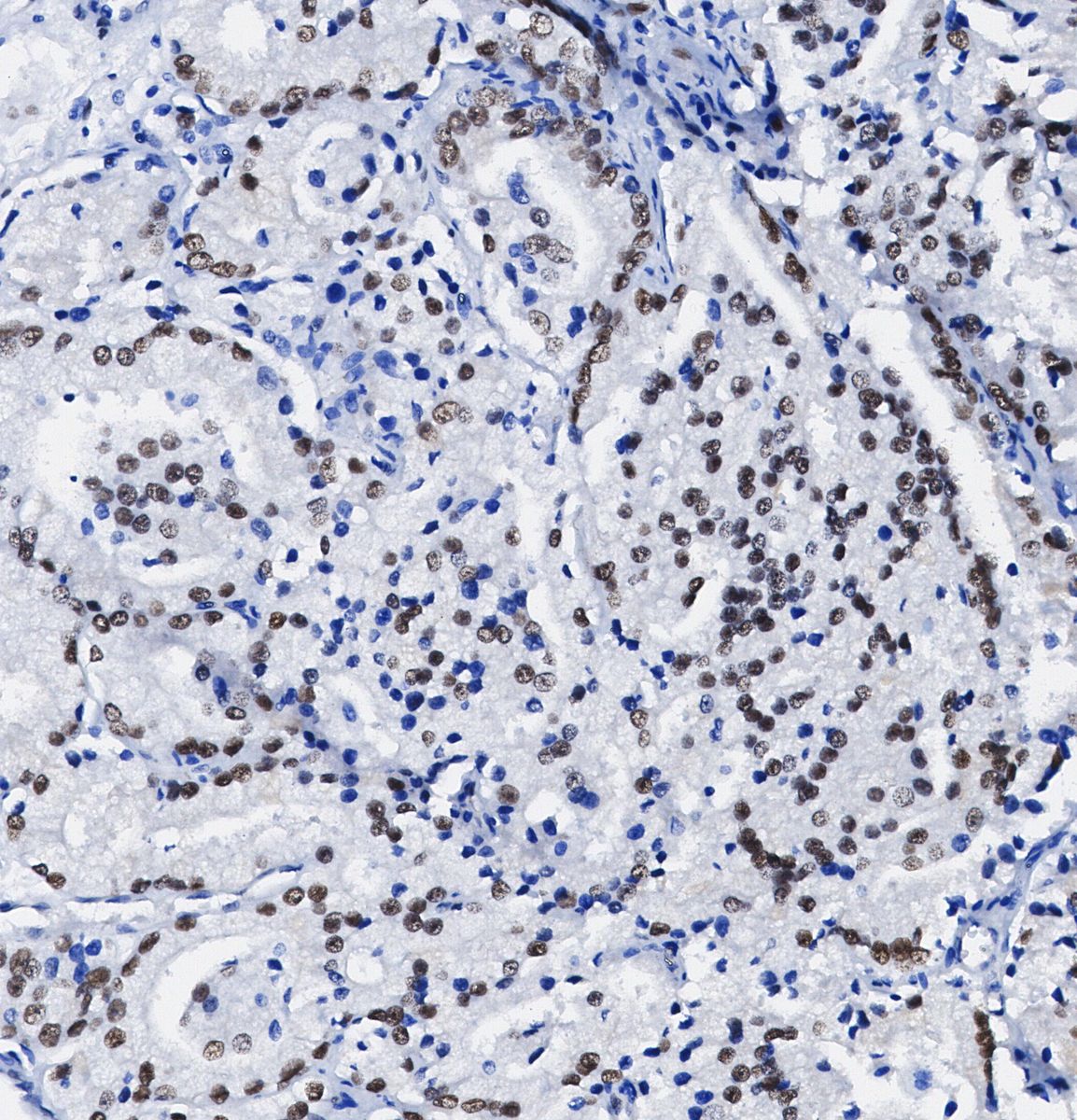 FOXC1 Antibody
