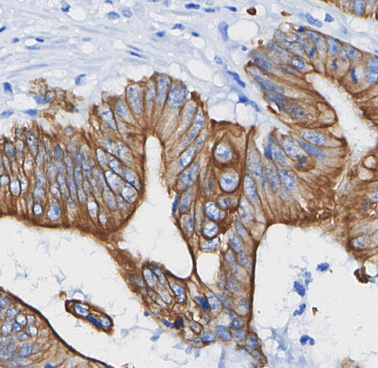 GAP43 Antibody