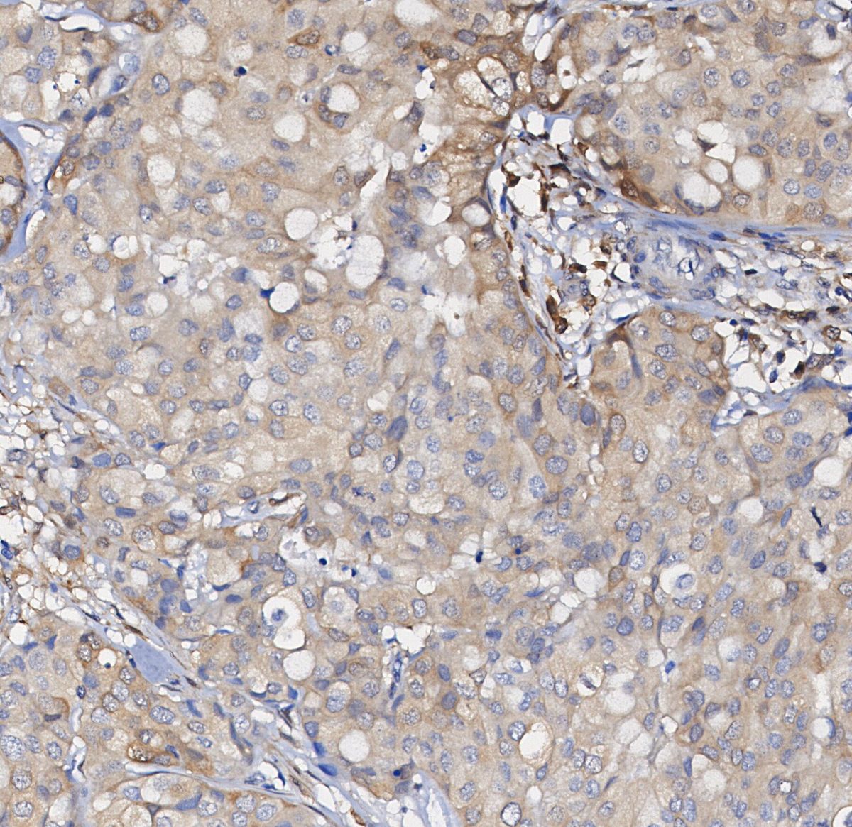 GDF15 Antibody