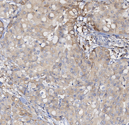 GDF15 Antibody