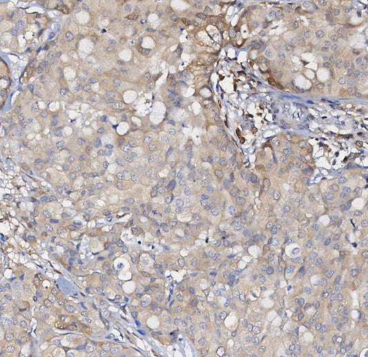 GDF15 Antibody