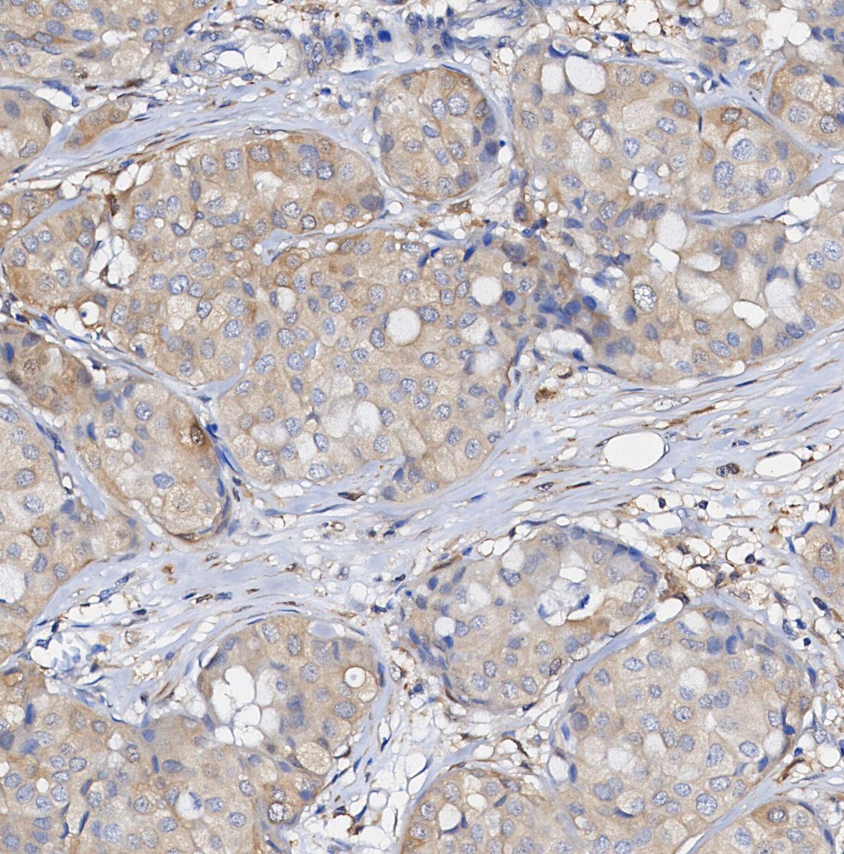Phospho-MEK1 (Ser298) Antibody