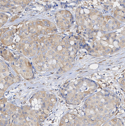 Phospho-MEK1 (Ser298) Antibody