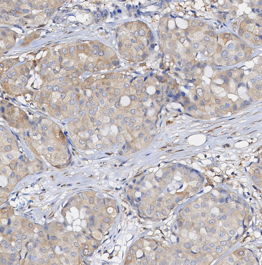 Phospho-MEK1 (Ser298) Antibody
