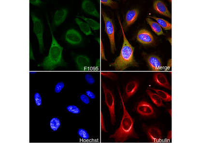 MEK1 Antibody