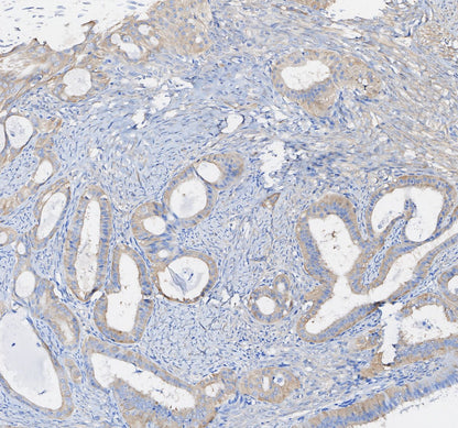 MEK1 Antibody