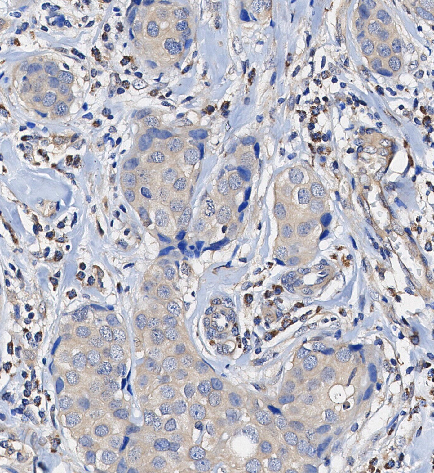 MEKK3 Antibody