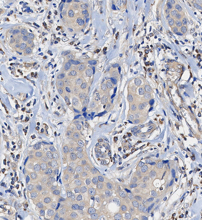 MEKK3 Antibody