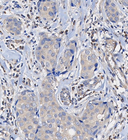MEKK3 Antibody