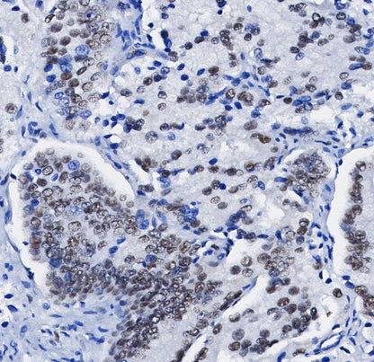 NRF1 Antibody