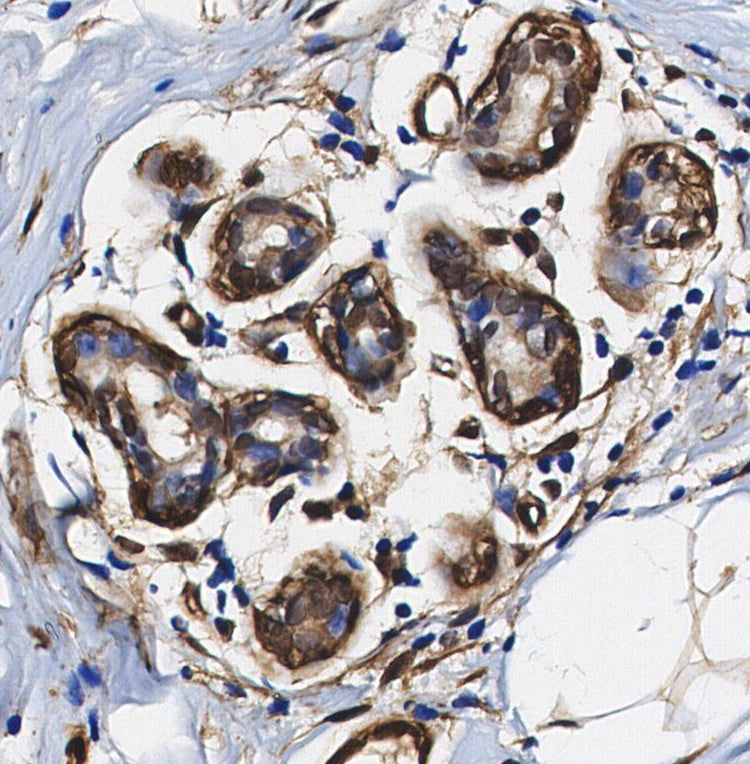 PSMD14 Antibody