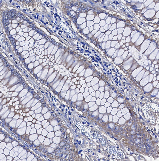 YB1 Antibody