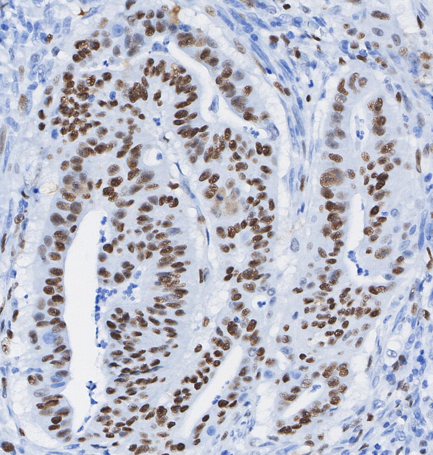 DNA PKcs Antibody