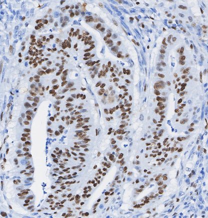 DNA PKcs Antibody