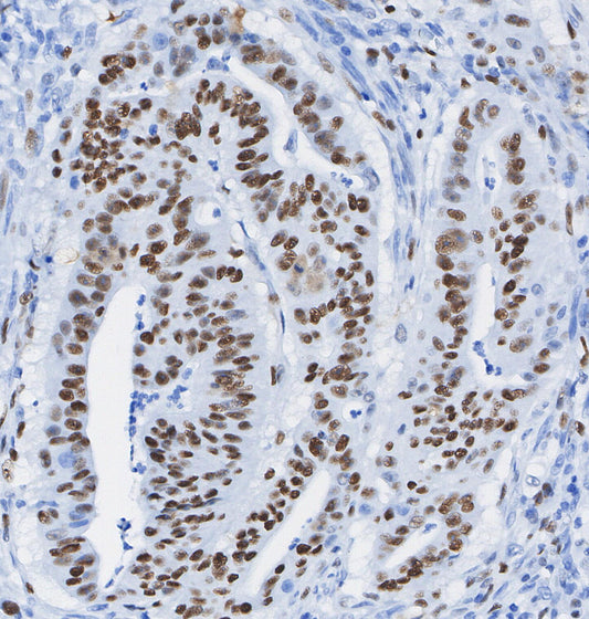 DNA PKcs Antibody