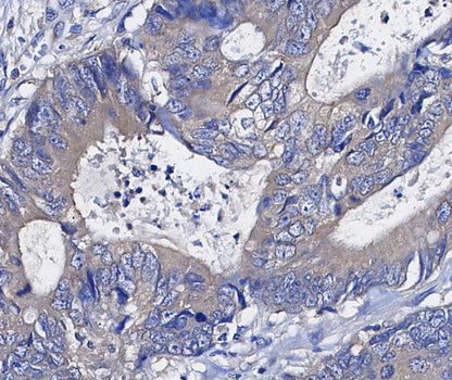 Hsp90 β Antibody