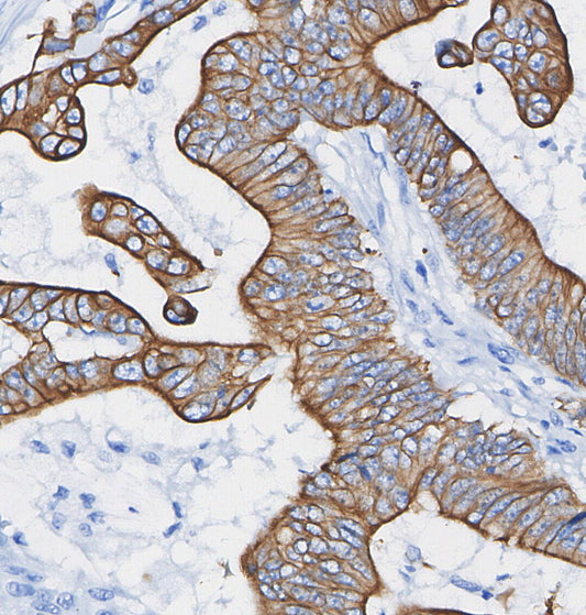 PAR2 Antibody