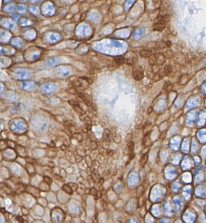 PGP9.5 Antibody