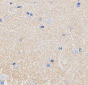 Pan Trk Antibody